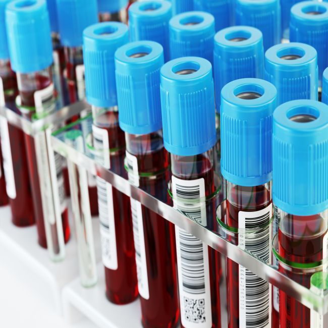 Onderzoek naar ‘anti-omikron plasma’ voor mensen met immuunstoornis